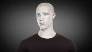 アルビノ宇宙人